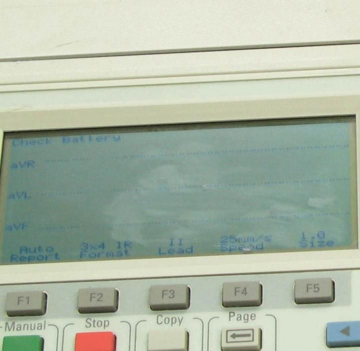 Agilent PageWriter 300PI M1770A Interpretive EKG Machine  